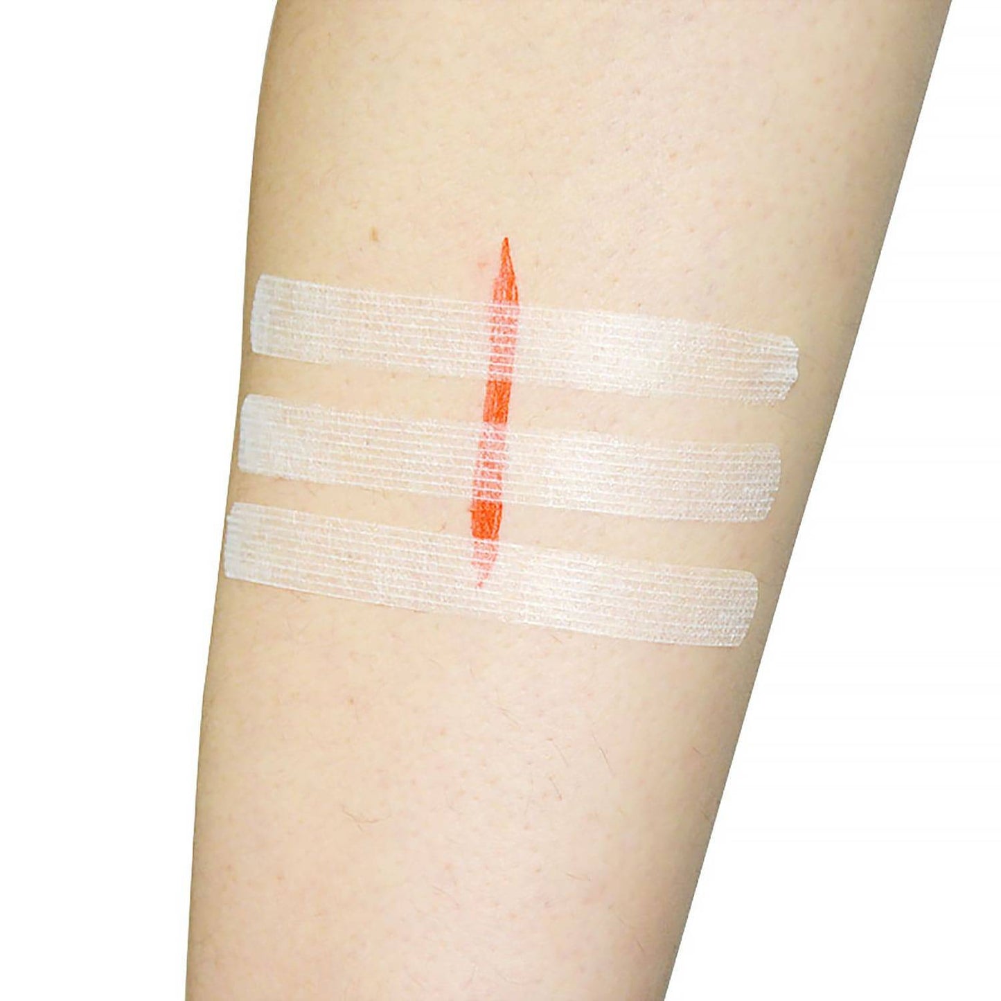 12mm x 100mm Teqler fiðrildi saumar (6 pakki)