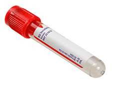 BD Vacutainer 2ml Plast Serum Tube Rauður